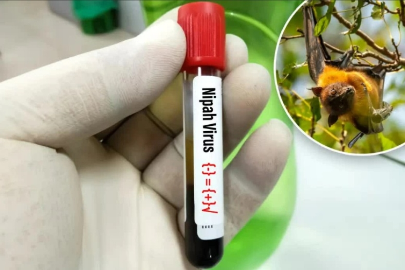 Những điều cần biết về virus Nipah